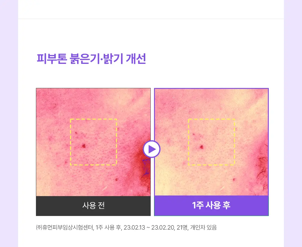 [잡티미백케어] 성분에디터 머루포도 비타 C 잡티크림 50g 상세페이지 31